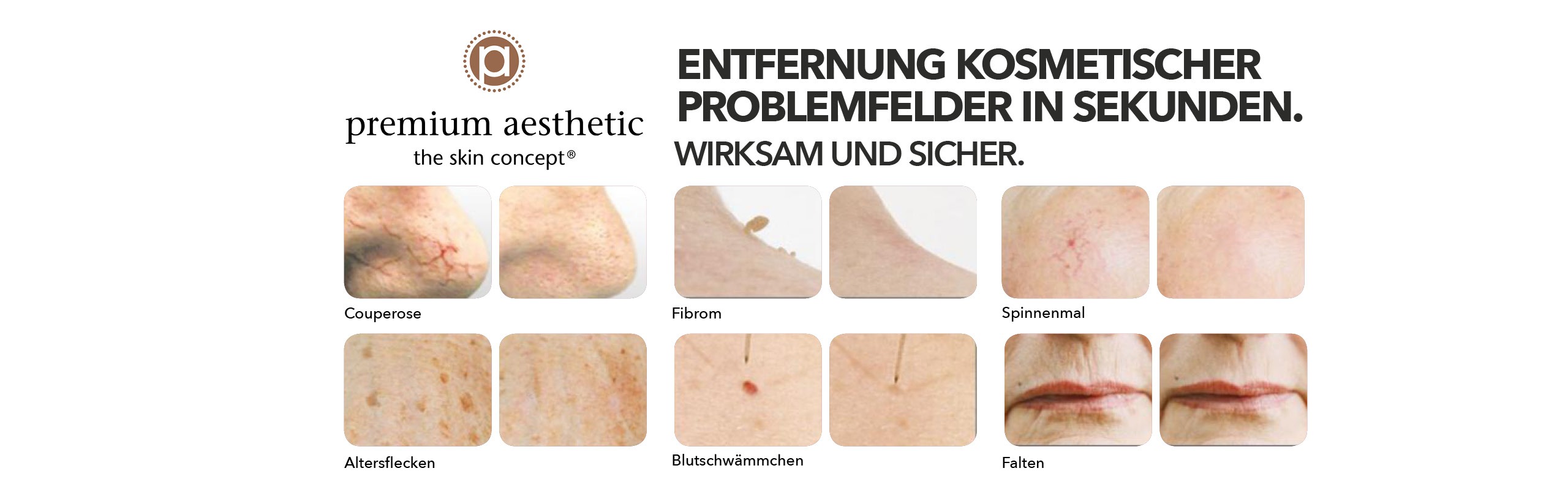 Premium Aestehtic Entfernung kosmetischer Problemfelder